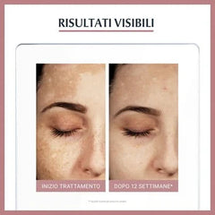 EUCERIN ANTI-PIGMENT DUAL SERUM