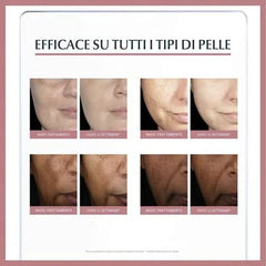 EUCERIN ANTI-PIGMENT DUAL SERUM