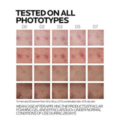 LA ROCHE POSAY EFFACLAR DUO+M