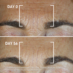 FILORGA GLOBAL-REPAIR ADVANCED ELIXIR