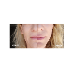 NEW ANGANCE ANTI-AGE MACHERA 25ML X 10 PZ