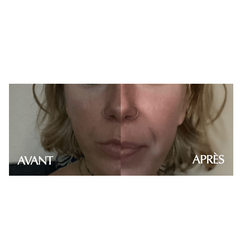 NEW ANGANCE WHITENING MASCHERA 25ML X 10 PZ