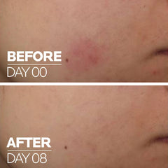 LA ROCHE POSAY CICAPLAST B5 SIERO